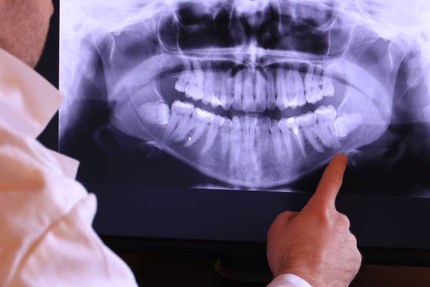 Best Cosmetic Emergency Dentistry in Ballville, OH
