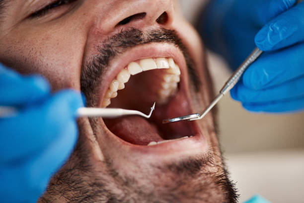 Best Emergency TMJ Treatment in Ballville, OH